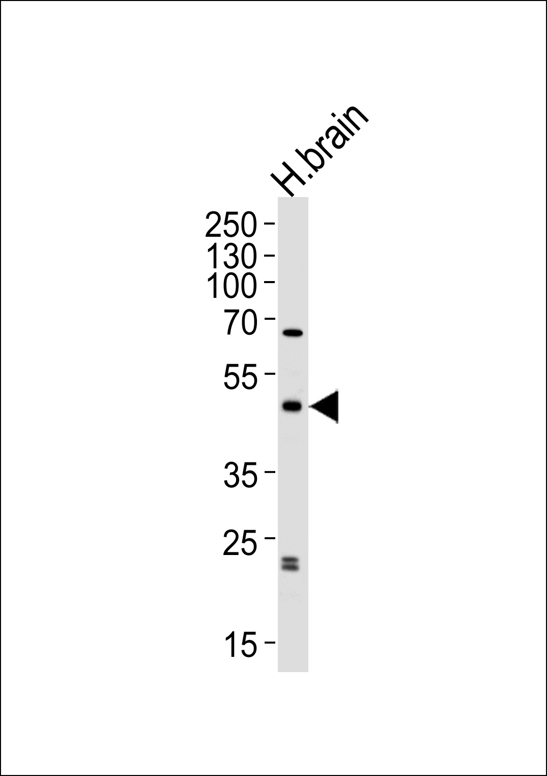 ABHD12 Antibody