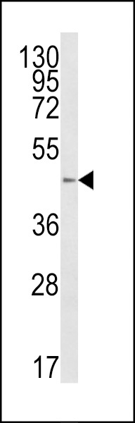 B4GalT1 Antibody