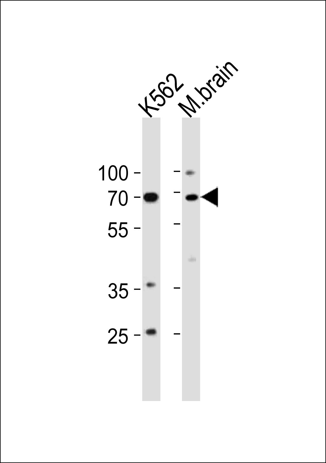 TP73 Antibody