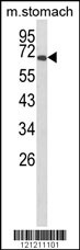 GLIS1 Antibody