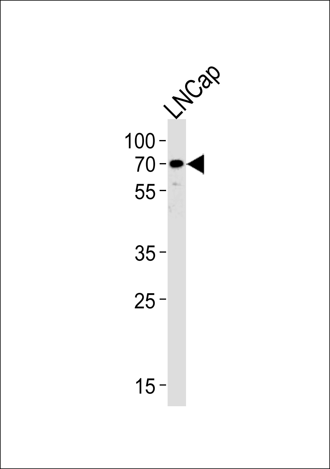 CYP51A1 Antibody