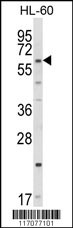 CYP51A1 Antibody