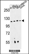 RPGRIP1 Antibody
