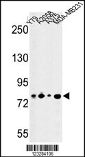 CSRP2BP Antibody
