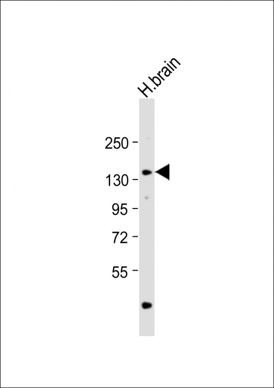 ADCY8 Antibody