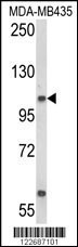 CASD1 Antibody