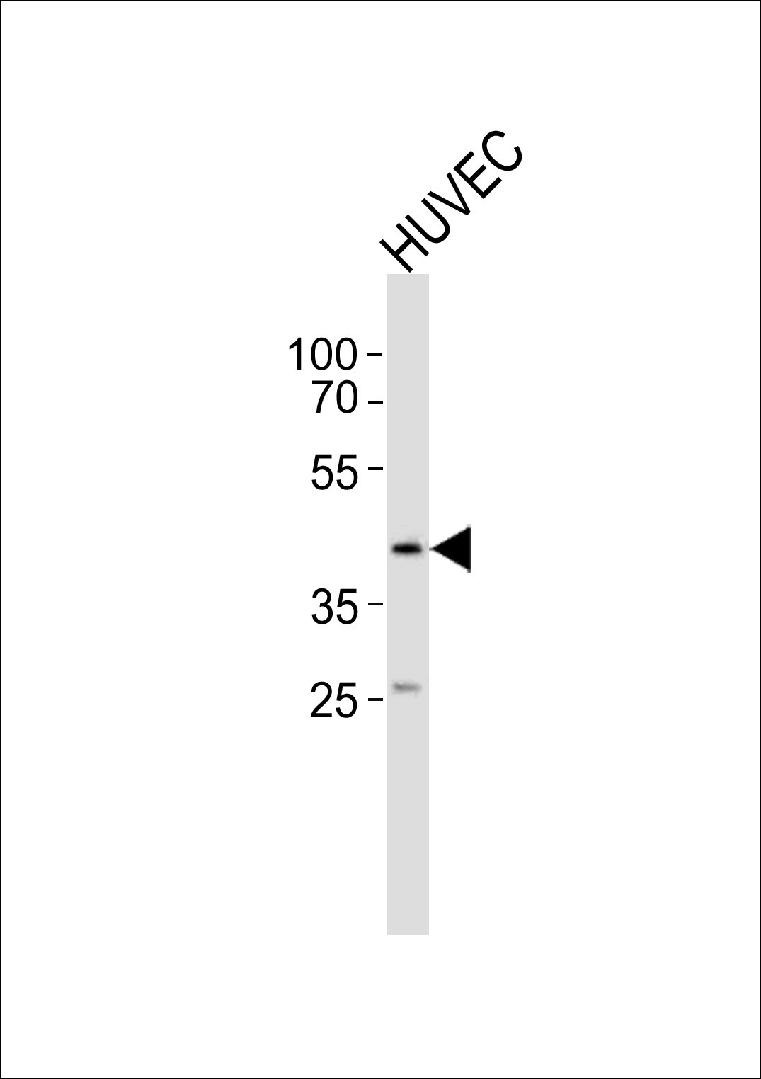 OLR1 Antibody