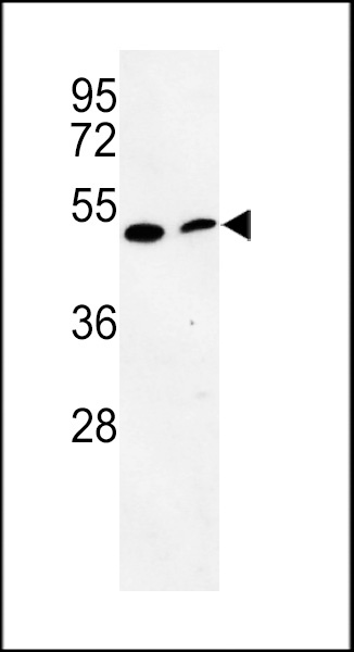 PISD Antibody
