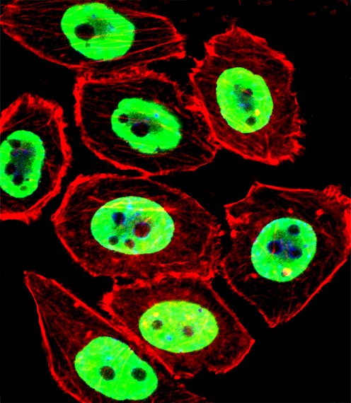 EWSR1 Antibody