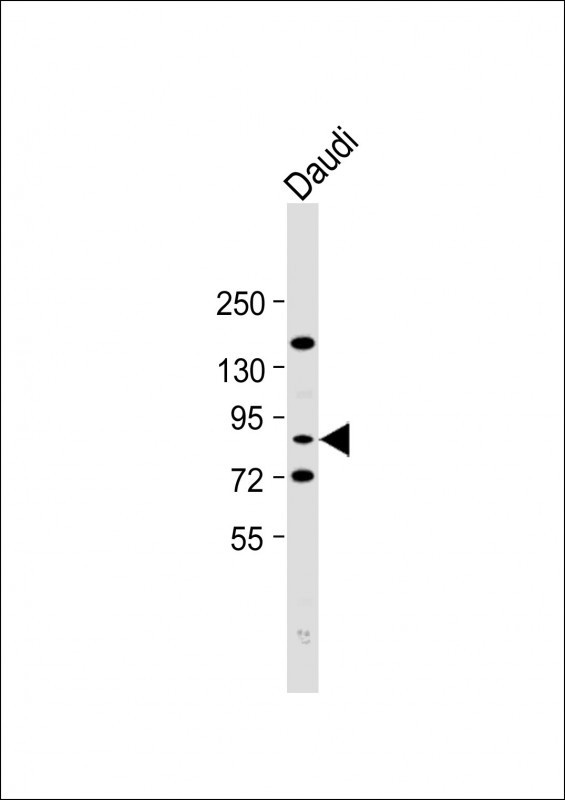 SCNN1A Antibody