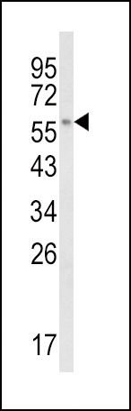 CYP8B1 Antibody