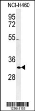 XPA Antibody