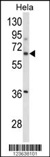 ITGBL1 Antibody