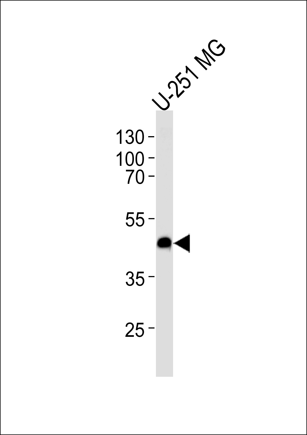 CXCR7 Antibody