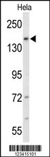 FNDC3B Antibody