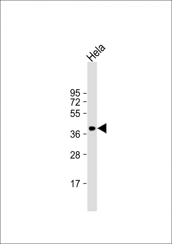 ARPC1B Antibody