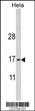 MPV17 Antibody