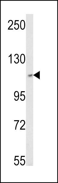 SKIV2L2 Antibody