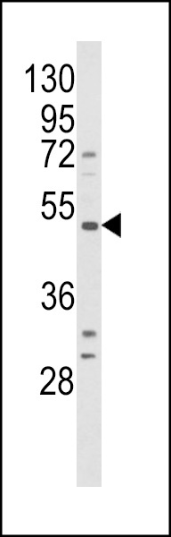 BDKRB1 Antibody