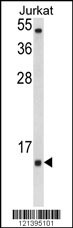 SOD1 Antibody