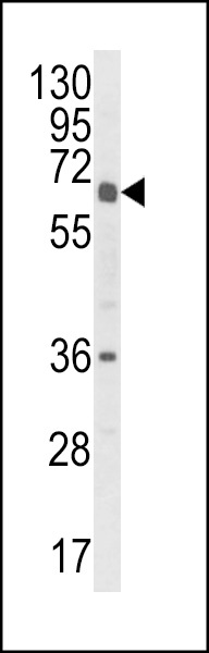 CYP2C18 Antibody