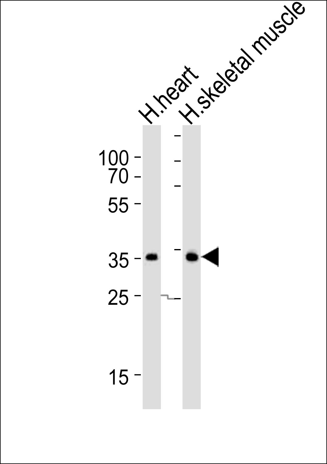 DIO2 Antibody