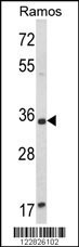 ACY3 Antibody