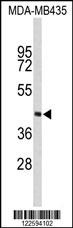 PHYH Antibody