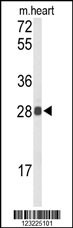 TSPAN1 Antibody