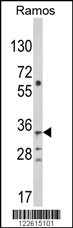 TBATA Antibody