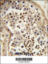 TBATA Antibody