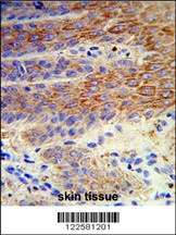 ATP12A Antibody