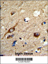 AGPAT3 Antibody