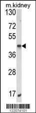 ALKBH3 Antibody