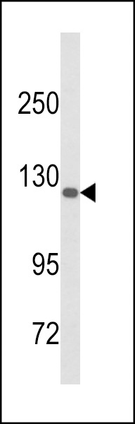 DSC1 Antibody