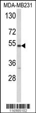 CYP2A13 Antibody