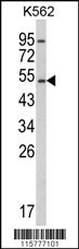 CYP2E1 Antibody