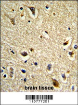 CYP2E1 Antibody