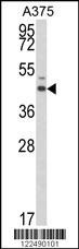 ESRRA Antibody