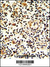 KLRD1 Antibody