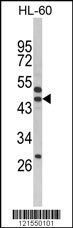 SERPINB7 Antibody