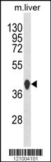 HPD Antibody