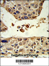 HPD Antibody