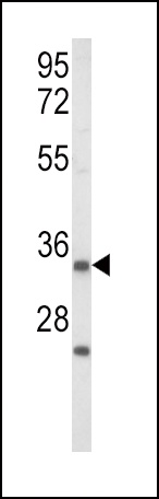 IGFBP2 Antibody