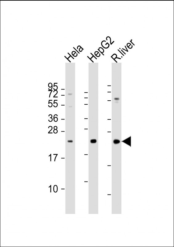 TSPAN31 Antibody