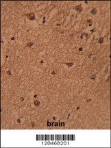 HSPC142 Antibody