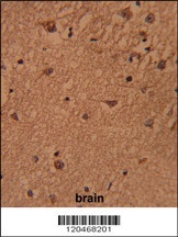 BABAM1 Antibody