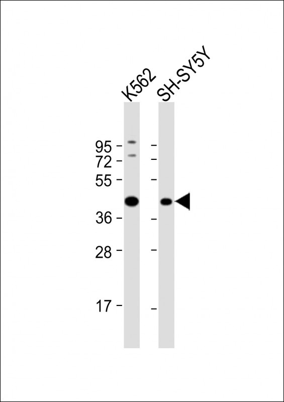 ADH5 Antibody