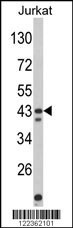 CECR5 Antibody