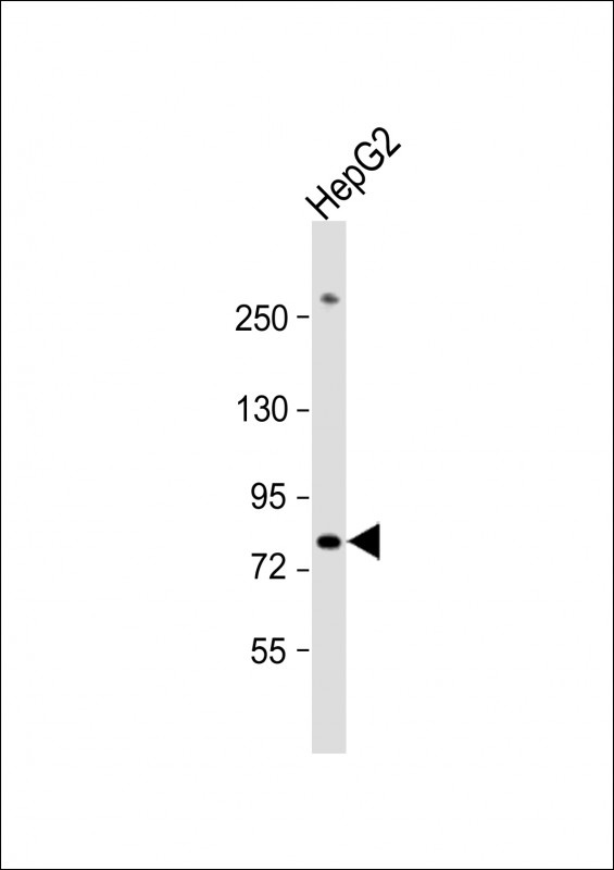 PIGR Antibody